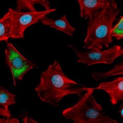 Brucella Infected Cells Brucella infected cells (AH1 -ovine trophoblast Ovine Trophoblast 2