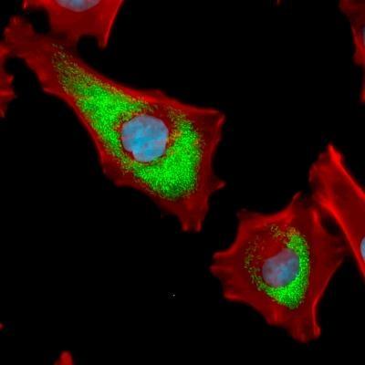 Brucella infected cells (AH1 -ovine trophoblast