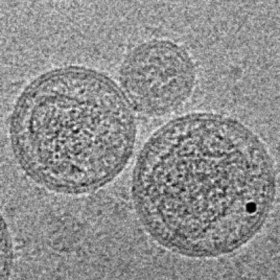 Porcine Endogenous Retrovirus 1